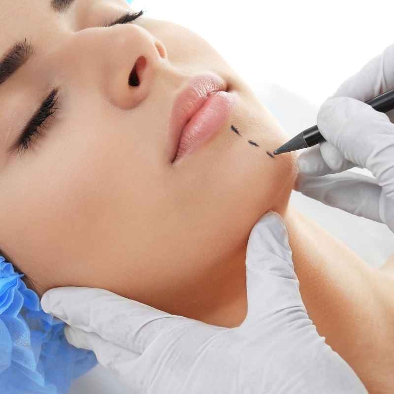 Chin Augmentation in Nashik by Dr. Neha Jain Aher