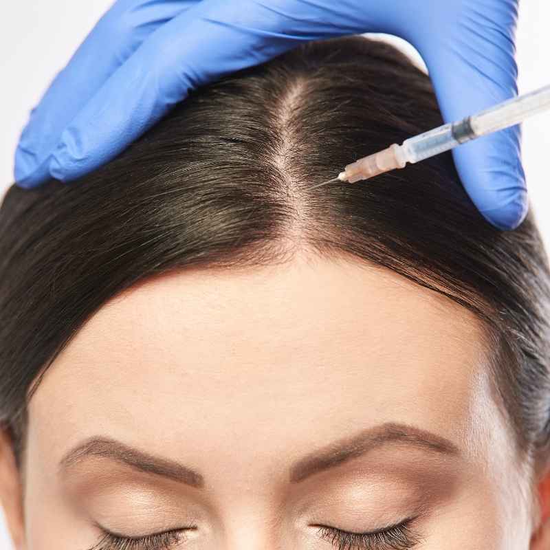 Platelet-Rich Plasma in Nashik by Dr. Neha Jain Aher