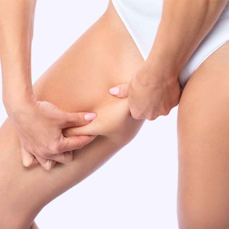 Thigh Lift in Nashik by Dr. Neha Jain Aher